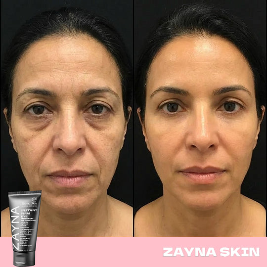 Regard Zéro Défaut – Effet Instantané