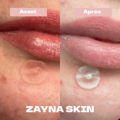 ZaynaDerma Patch